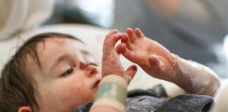 تولید پانسمان بیماران پروانهای توسط جوانان نخبه اصفهانی