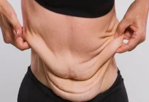 دردهای چاقی و لاغری چندباره